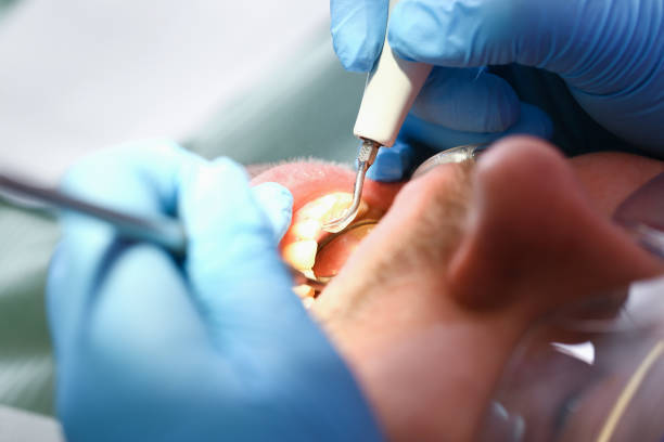 Best Emergency Denture Repair in East Richmond Heights, CA