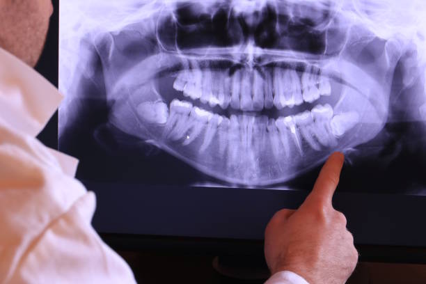 Best Pediatric Emergency Dentist in East Richmond Heights, CA